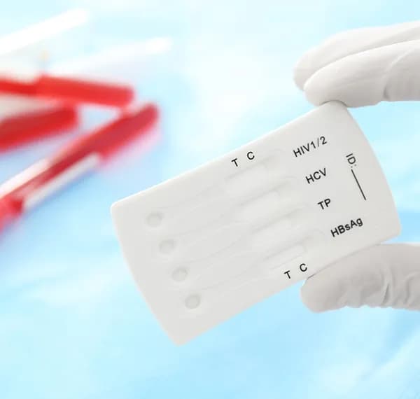 Вирус иммунодефицита человека (Human Immunodeficiency Virus), качественное суммарное определение антител к 1 и 2 типу вируса и антигена p24 anti-HIV1