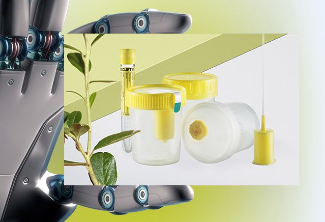 Трёхстаканная проба мочи