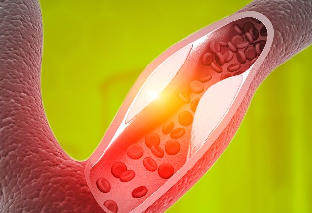 Диагностика нарушений липидного обмена - триглицериды