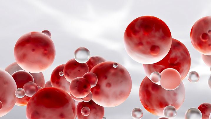 Повышенные эритроциты в крови: что это значит. Нормы, причины повышения, дополнительные обследования и лечение  — ЛабКвест