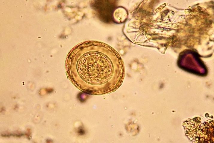 Гименолепидоз — ЛабКвест