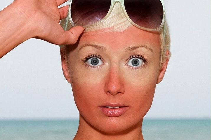 Эритема — ЛабКвест