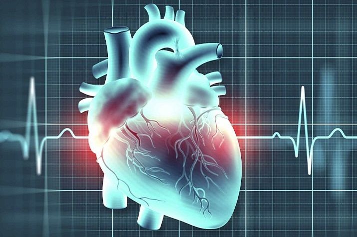 Аритмия сердца — ЛабКвест