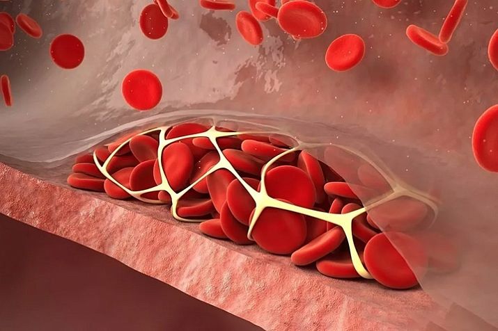 Коагулограмма — ЛабКвест